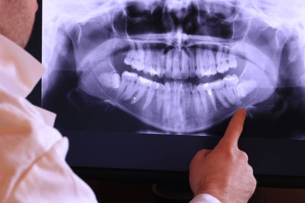 Best Emergency TMJ Treatment in New York Mills, MN