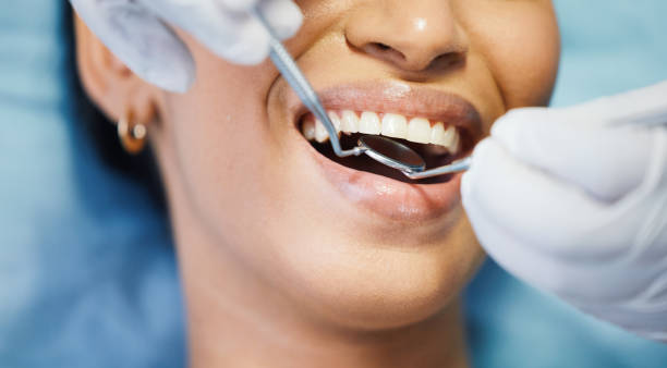 Best Emergency Gum Treatment in New York Mills, MN
